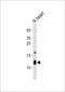 ATP Synthase Peripheral Stalk Subunit F6 antibody, LS-C156660, Lifespan Biosciences, Western Blot image 