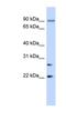 Josephin Domain Containing 2 antibody, NBP1-56709, Novus Biologicals, Western Blot image 