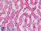 Aldehyde Dehydrogenase 5 Family Member A1 antibody, LS-B9003, Lifespan Biosciences, Immunohistochemistry paraffin image 