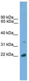 Adaptor Related Protein Complex 3 Subunit Sigma 1 antibody, TA340006, Origene, Western Blot image 
