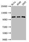 Epithelial Cell Transforming 2 antibody, CSB-PA888001LA01HU, Cusabio, Western Blot image 