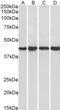 Protein Phosphatase 1 Regulatory Subunit 8 antibody, PA5-18180, Invitrogen Antibodies, Western Blot image 