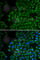 Tyrosinase antibody, A1254, ABclonal Technology, Immunofluorescence image 