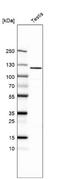 Tubulin Tyrosine Ligase Like 4 antibody, NBP1-81535, Novus Biologicals, Western Blot image 