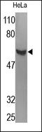 Tubulin Beta 1 Class VI antibody, 252191, Abbiotec, Immunohistochemistry paraffin image 