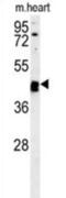 Tubulointerstitial Nephritis Antigen Like 1 antibody, abx025700, Abbexa, Western Blot image 