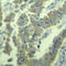 Myristoylated Alanine Rich Protein Kinase C Substrate antibody, STJ22281, St John