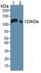 LIF Receptor Subunit Alpha antibody, LS-C295143, Lifespan Biosciences, Western Blot image 