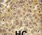 DEAD-Box Helicase 3 X-Linked antibody, PA5-11561, Invitrogen Antibodies, Immunohistochemistry paraffin image 