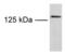 Transient receptor potential cation channel subfamily M member 8 antibody, PA1-46239, Invitrogen Antibodies, Western Blot image 