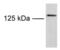 Transient Receptor Potential Cation Channel Subfamily M Member 8 antibody, PA1-46239, Invitrogen Antibodies, Western Blot image 