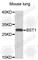 Bone Marrow Stromal Cell Antigen 1 antibody, A9900, ABclonal Technology, Western Blot image 