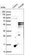Phosphatidylinositol 4-Kinase Type 2 Beta antibody, HPA004099, Atlas Antibodies, Western Blot image 