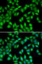 Myosin Light Chain 3 antibody, STJ28745, St John