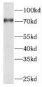 RDX antibody, FNab07222, FineTest, Western Blot image 