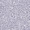 Lemur Tyrosine Kinase 3 antibody, HPA077070, Atlas Antibodies, Immunohistochemistry frozen image 