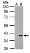 Actin Related Protein 2/3 Complex Subunit 1A antibody, PA5-34870, Invitrogen Antibodies, Western Blot image 