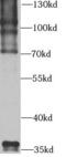 Ubiquitin C antibody, FNab09152, FineTest, Western Blot image 