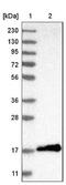 Eukaryotic Translation Initiation Factor 4E Binding Protein 1 antibody, NBP1-89368, Novus Biologicals, Western Blot image 