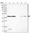 Prune Exopolyphosphatase 1 antibody, PA5-55842, Invitrogen Antibodies, Western Blot image 