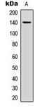 Collagen Type II Alpha 1 Chain antibody, MBS8210940, MyBioSource, Western Blot image 