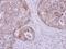 Kinesin Family Member 17 antibody, GTX116681, GeneTex, Immunohistochemistry paraffin image 