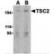 TSC Complex Subunit 2 antibody, MBS151308, MyBioSource, Western Blot image 