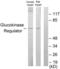 Glucokinase regulatory protein antibody, LS-C119039, Lifespan Biosciences, Western Blot image 