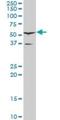 HNF1 Homeobox B antibody, H00006928-M06, Novus Biologicals, Western Blot image 