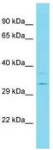 Ubiquitin Specific Peptidase 39 antibody, TA343625, Origene, Western Blot image 