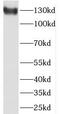 Signal Peptide, CUB Domain And EGF Like Domain Containing 3 antibody, FNab07660, FineTest, Western Blot image 