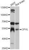 Carboxypeptidase Vitellogenic Like antibody, LS-C747477, Lifespan Biosciences, Western Blot image 