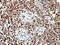 Origin Recognition Complex Subunit 3 antibody, NBP2-19632, Novus Biologicals, Immunohistochemistry paraffin image 