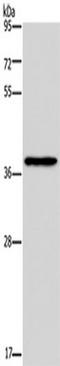 Poly(RC) Binding Protein 4 antibody, TA351388, Origene, Western Blot image 