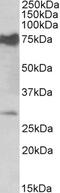 NADPH Oxidase 1 antibody, 42-316, ProSci, Enzyme Linked Immunosorbent Assay image 