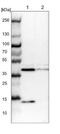 Acyl-CoA Dehydrogenase Short Chain antibody, NBP1-89290, Novus Biologicals, Western Blot image 