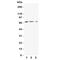 Solute Carrier Family 16 Member 1 antibody, R31310, NSJ Bioreagents, Western Blot image 