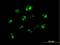 Nucleophosmin/Nucleoplasmin 3 antibody, H00010360-B01P, Novus Biologicals, Immunofluorescence image 