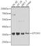 General Transcription Factor IIH Subunit 3 antibody, A7188, ABclonal Technology, Western Blot image 