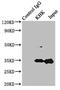 Ketohexokinase antibody, LS-C675942, Lifespan Biosciences, Immunoprecipitation image 