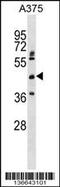 Aspartate Beta-Hydroxylase Domain Containing 2 antibody, 59-002, ProSci, Western Blot image 