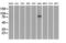 SATB Homeobox 1 antibody, GTX83685, GeneTex, Western Blot image 
