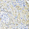 Heterogeneous Nuclear Ribonucleoprotein L antibody, 23-578, ProSci, Immunohistochemistry frozen image 