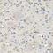 Microtubule Associated Protein 1 Light Chain 3 Beta antibody, LS-C746932, Lifespan Biosciences, Immunohistochemistry paraffin image 