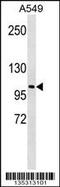 Lysyl oxidase homolog 2 antibody, 58-282, ProSci, Western Blot image 