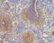 ARPC1B antibody, A07192-2, Boster Biological Technology, Immunohistochemistry paraffin image 