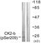 Casein Kinase 2 Beta antibody, LS-C198806, Lifespan Biosciences, Western Blot image 