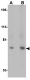Fermitin Family Member 3 antibody, GTX85027, GeneTex, Western Blot image 