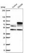 Probable ATP-dependent RNA helicase DDX59 antibody, PA5-61454, Invitrogen Antibodies, Western Blot image 