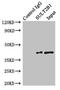 Sulfotransferase Family 2B Member 1 antibody, LS-C376721, Lifespan Biosciences, Immunoprecipitation image 